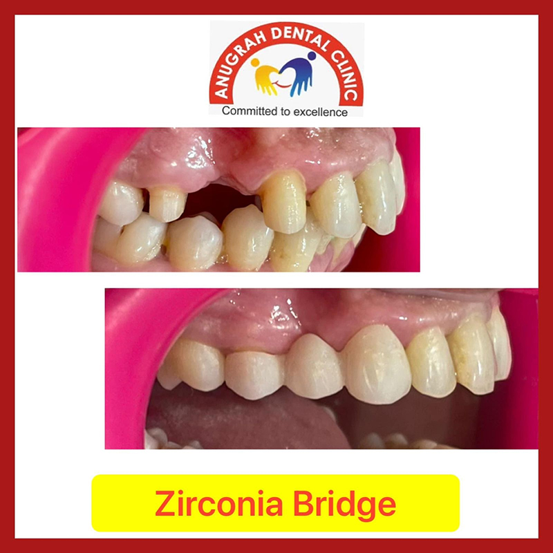 Family dental package
