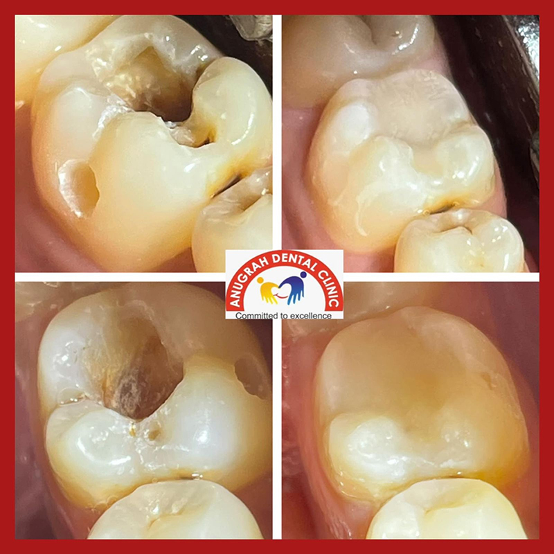 Orthodontic Clinic in Lucknow