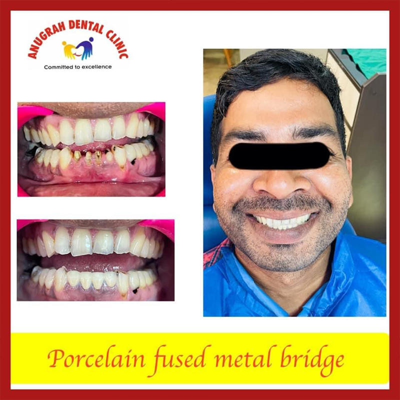 Top Dentist in Lucknow