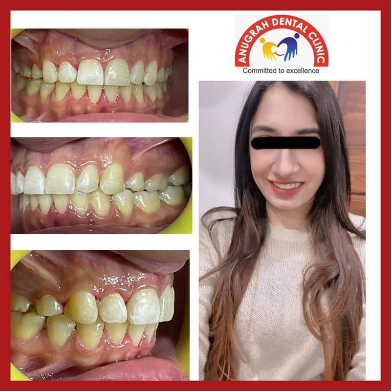 Best Dentist in Lucknow